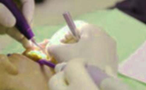 拔牙记作文优选15篇