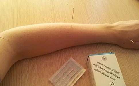 针灸个人考核年度总结范文